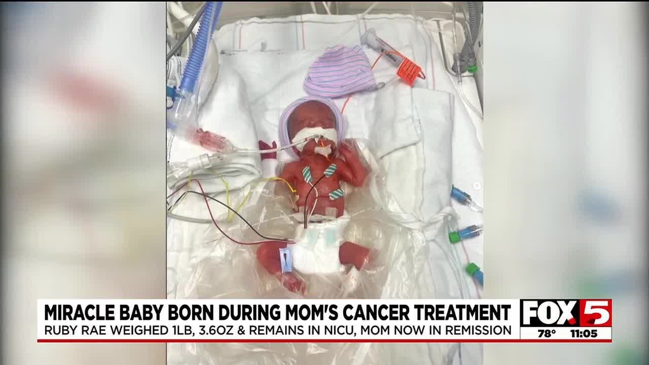 Miracle baby born during mother’s cancer treatment faces surgery before coming home to Vegas for...