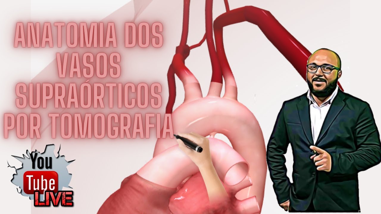 [ANATOMIA SECCIONAL] VASOS SUPRAORTICOS POR TOMOGRAFIA