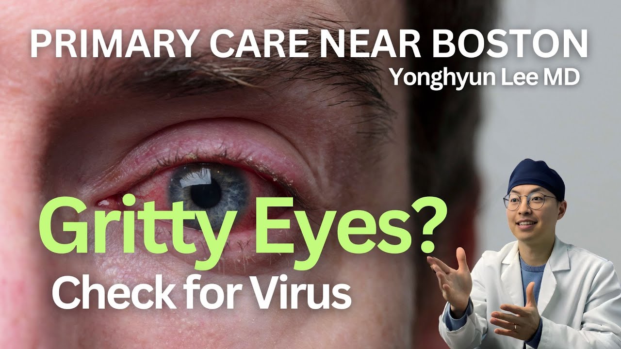 👁️ Viral Conjunctivitis: What You Need to Know! 🚨