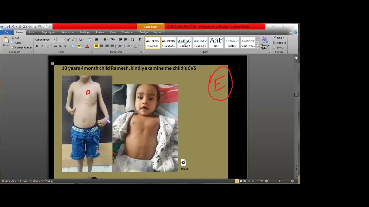 MRCPCH CLINICAL - CVS PRACTICE SESSION