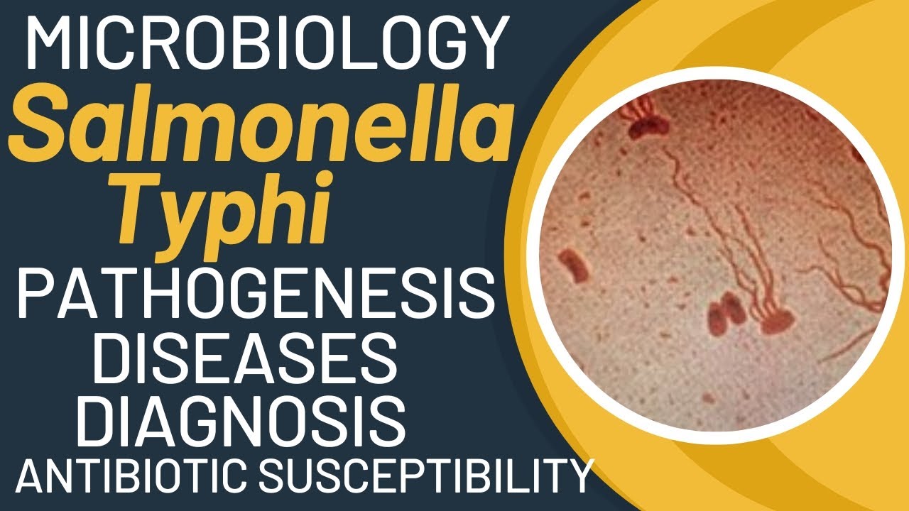 Salmonella typhi microbiology | Typhoid fever pathogenesis by salmonella typhimurium