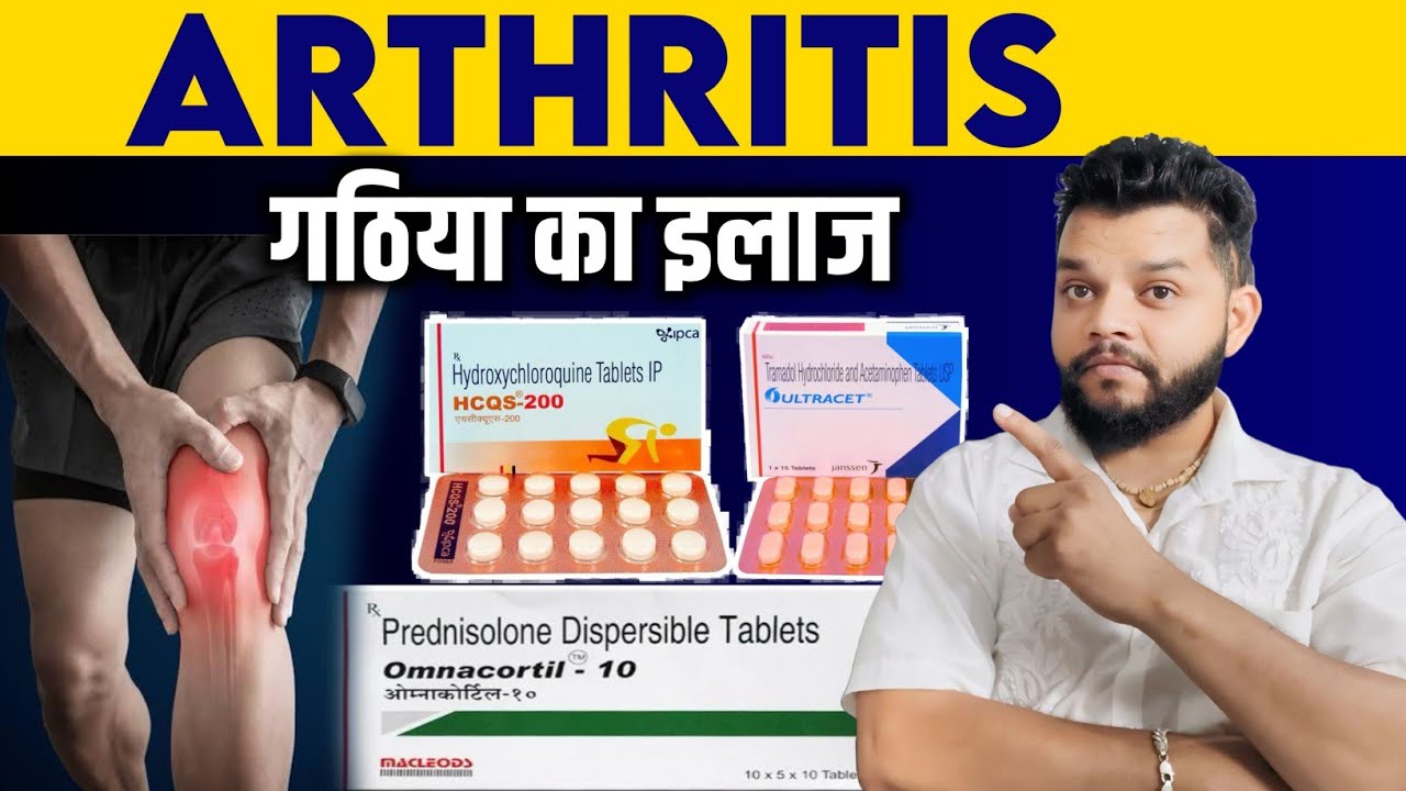 गठिया का एलोपथिक इलाज / Arthritis Allopathic Treatment In Hindi