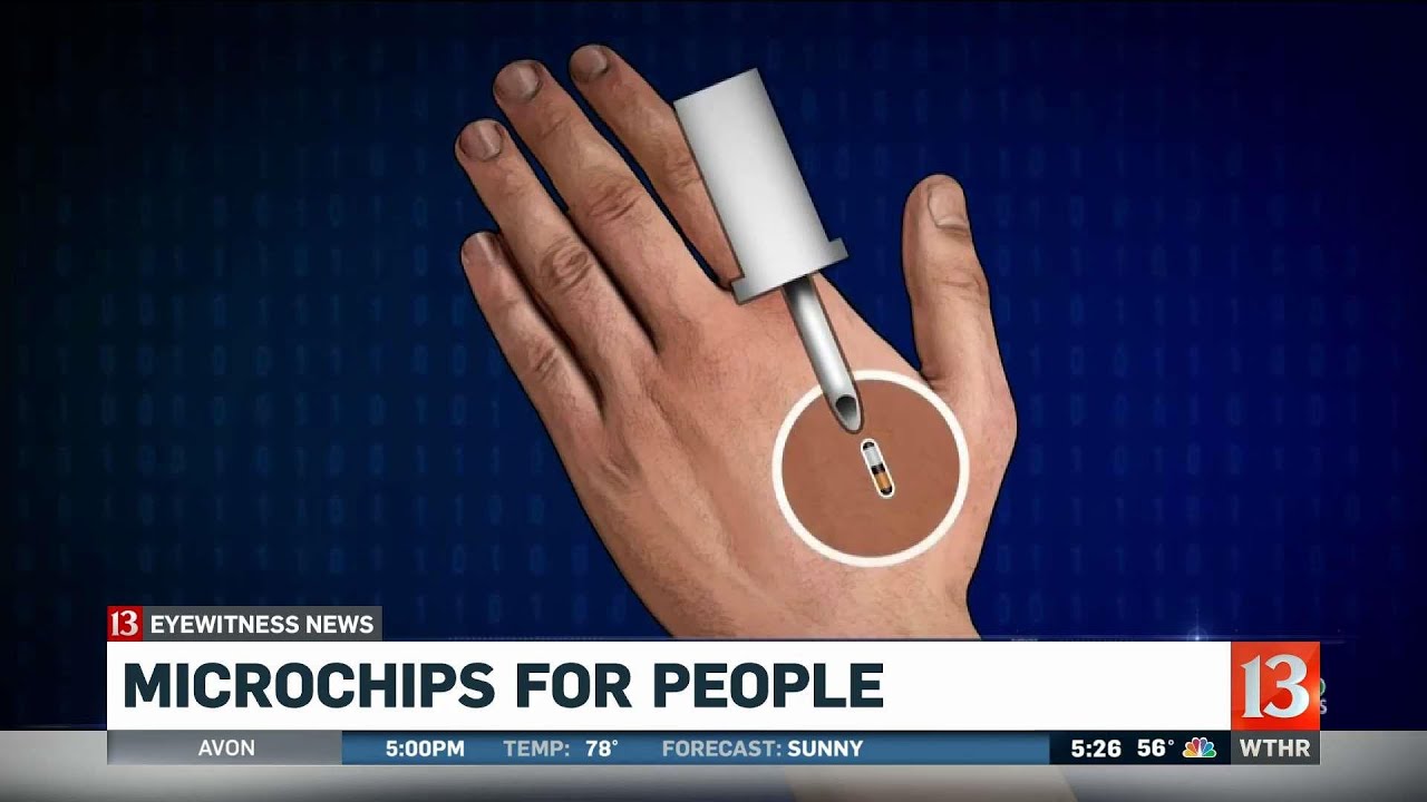 Microchipping Alzheimer's patients