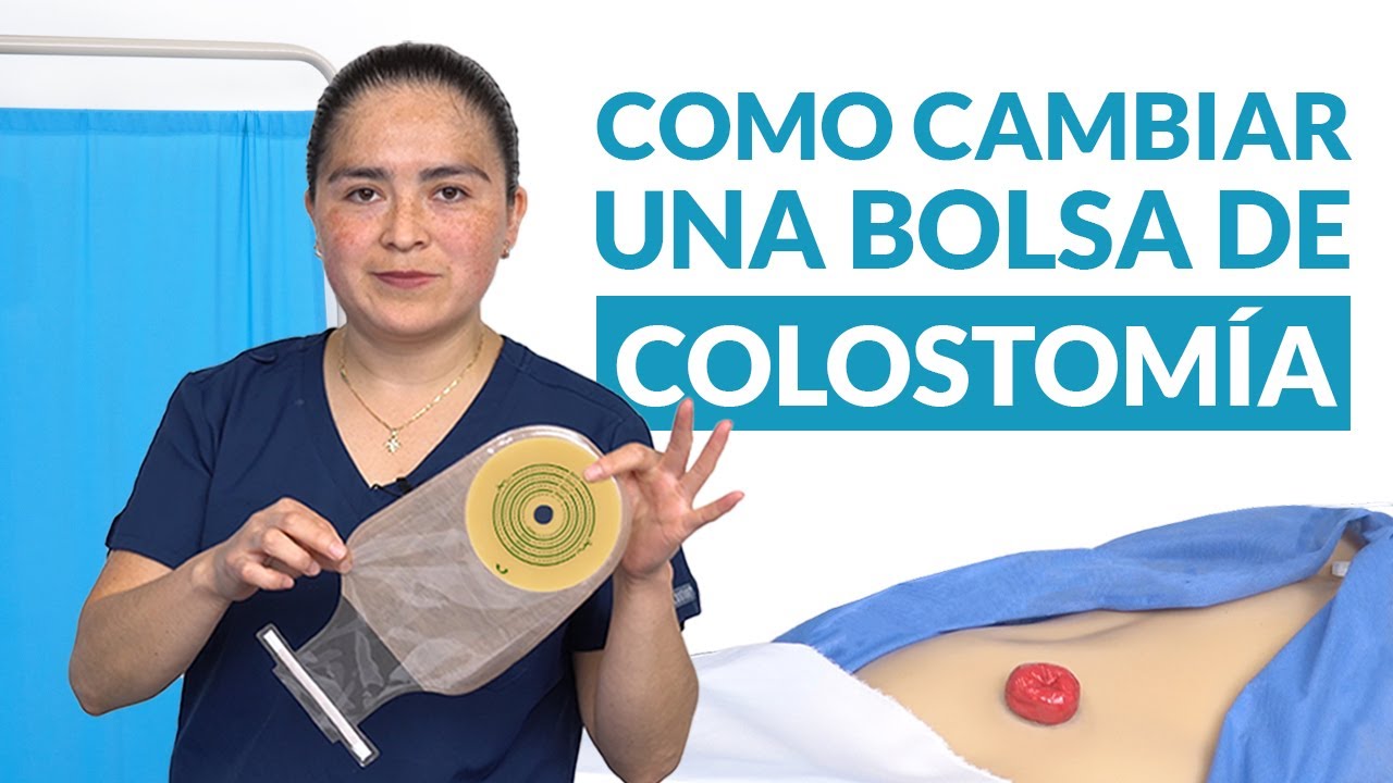 VIDEO INFORMATIVO | ¿CÓMO CAMBIAR LA BOLSA DE COLOSTOMÍA? | MAGNIMED