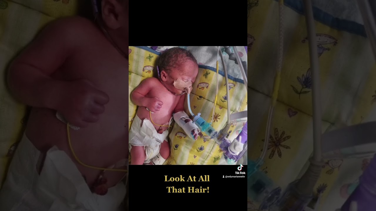 30 weeks preterm baby! #pretermlabor #pretermbaby #nicu #babyboy #littlechamps