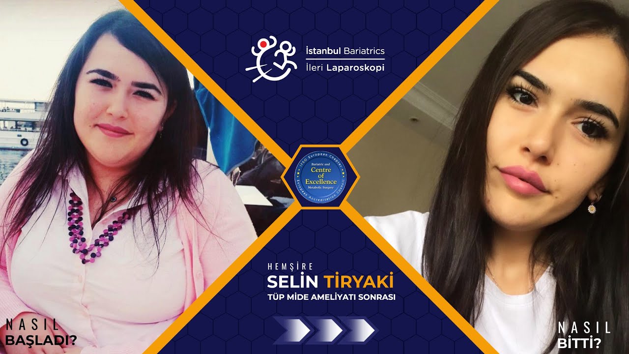 Acıbadem Fulya Hemşiresi Selin Tiryaki'nin Tüp Mide Ameliyatı Süreci Nasıl Başladı? Nasıl Bitti?