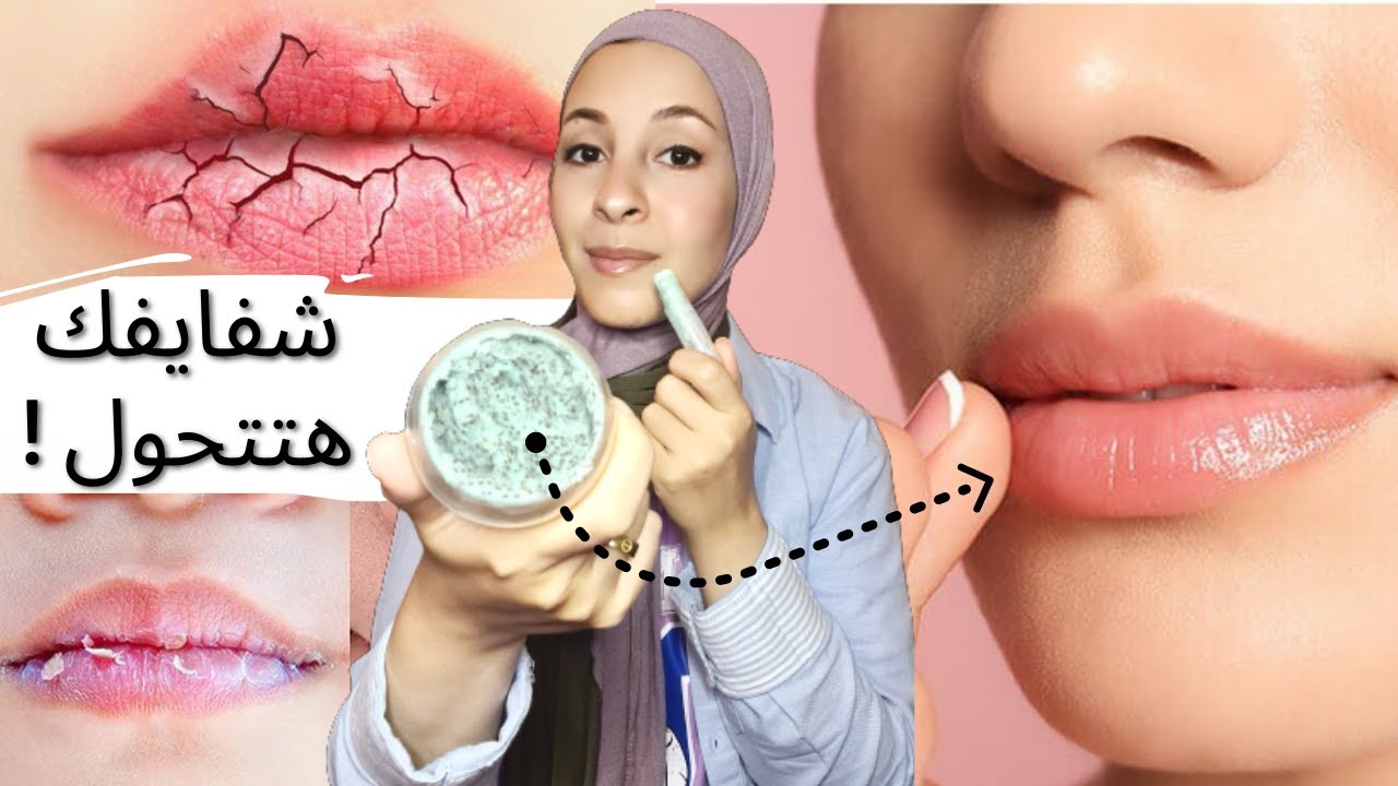 مكونين فقط { هيحولوا شفايفك } من جافة ومتشققة لناعمة وردية ممتلئة | LIP BALM AND SCRUB