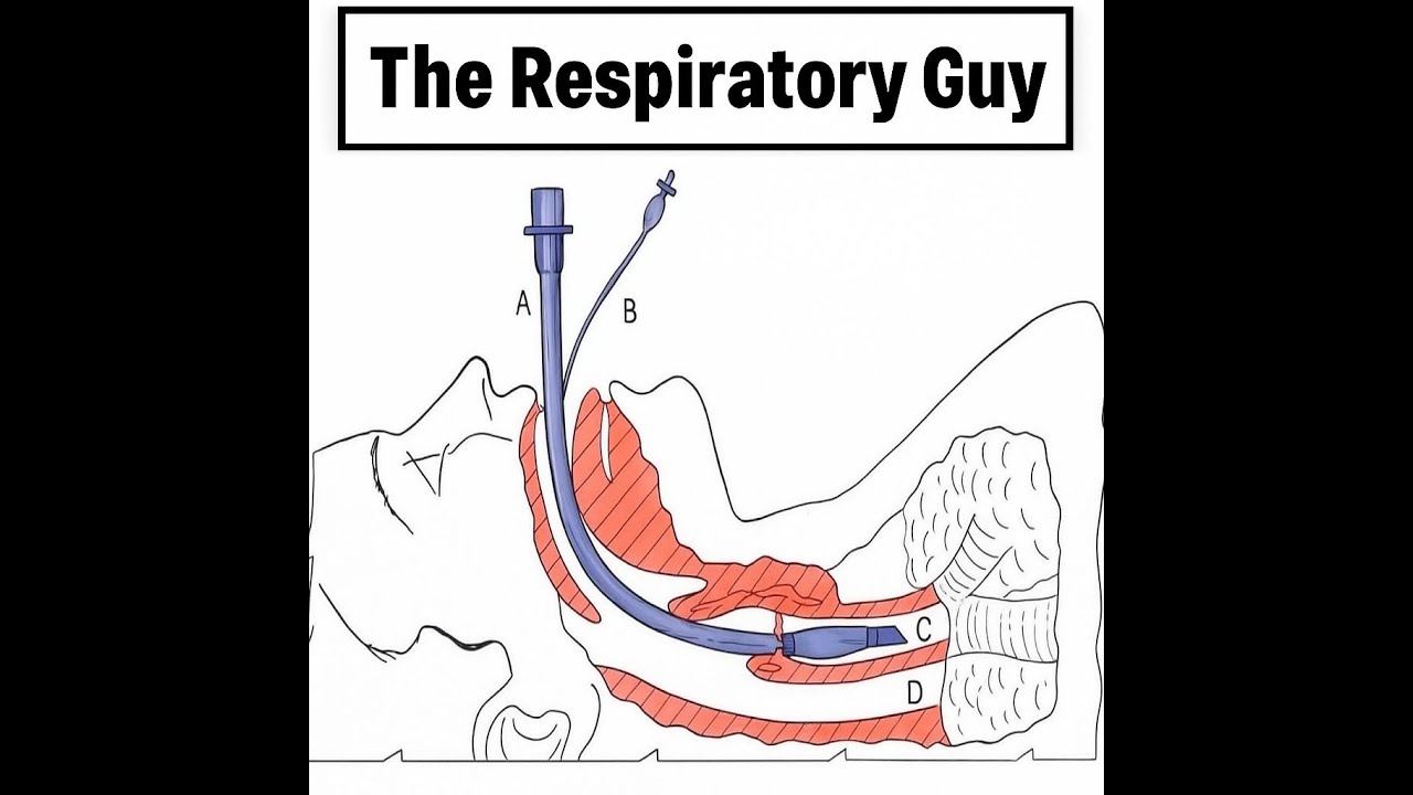 The Respiratory Guy Skills Series: Intro to Intubation for Respiratory Therapist