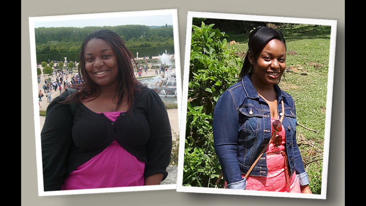 How it feels before and after losing weight with gastric sleeve surgery (pt 1)
