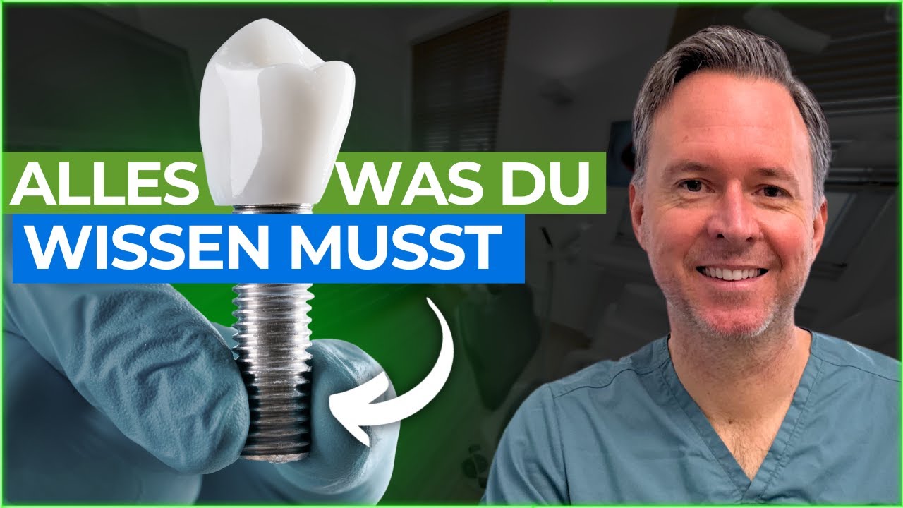 Der ultimative Zahnimplantat-Guide 2025 – Alles, was du wissen musst!