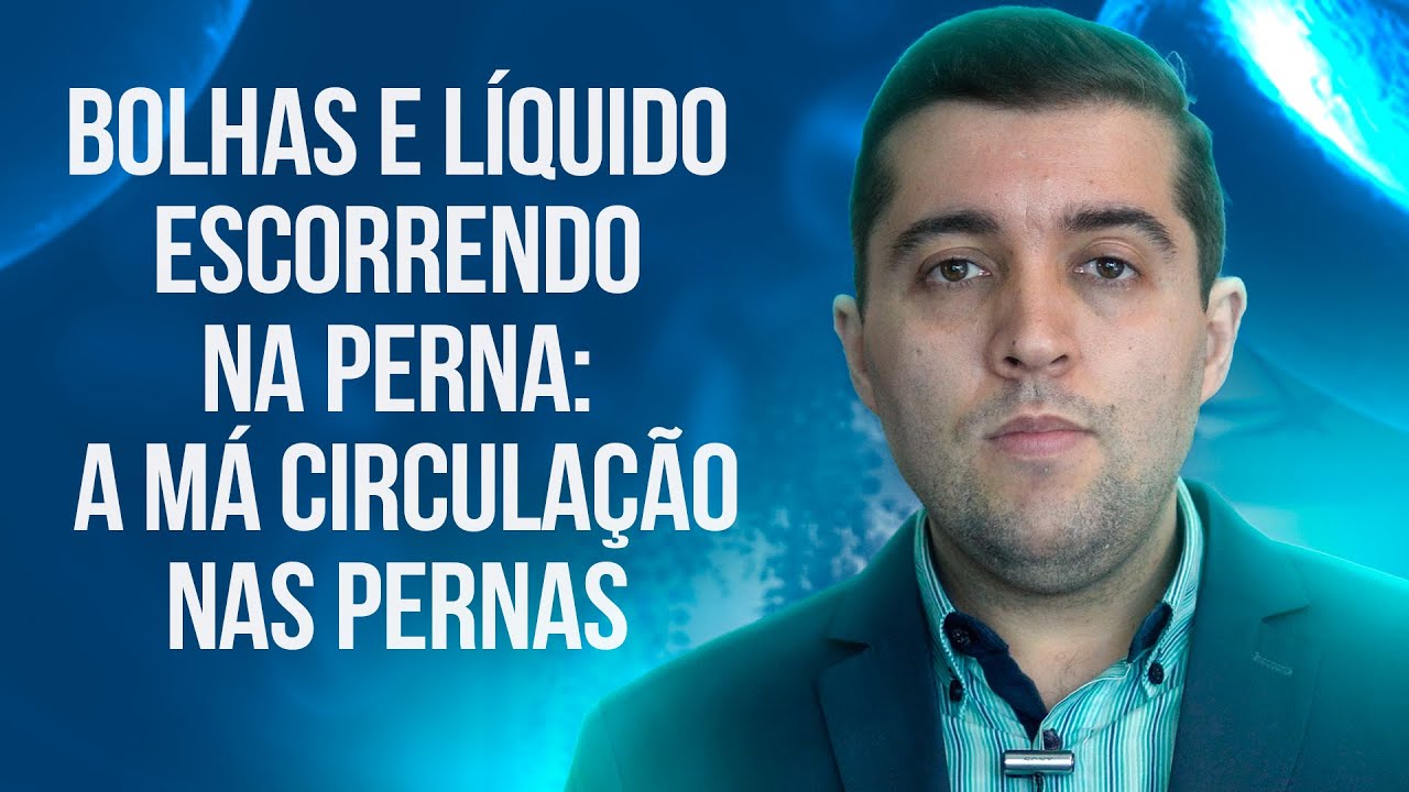 Perna vermelha, quente, com bolhas, feridas e saindo l&iacute;quido: a m&aacute; circula&ccedil;&atilde;o nas veias da perna