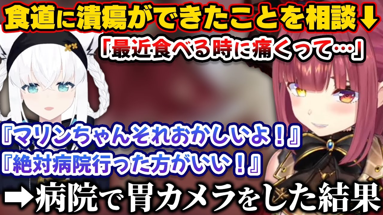 フブちゃん＆マネちゃんに食道に潰瘍ができたことを相談してみたらすごく心配されて病院で胃カメラすることを決意したマリン船長【ホロライブ切り抜き/宝鐘マリン/白上フブキ】