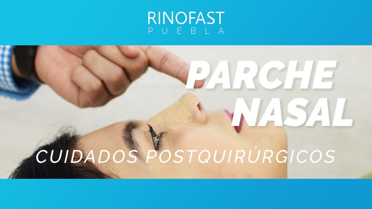 Parche nasal Rinofast Puebla