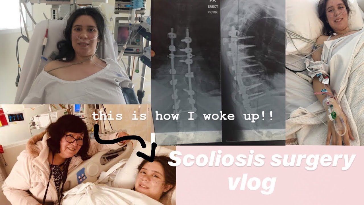 scoliosis surgery vlog! spinal fusion at 20 years old// Australian vlogger