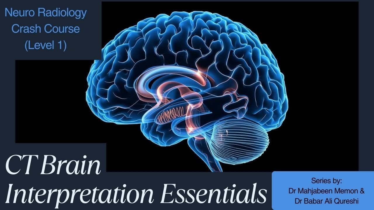 Essentials of CT Scan Brain Interpretation- Basics of How to read a CT Scan