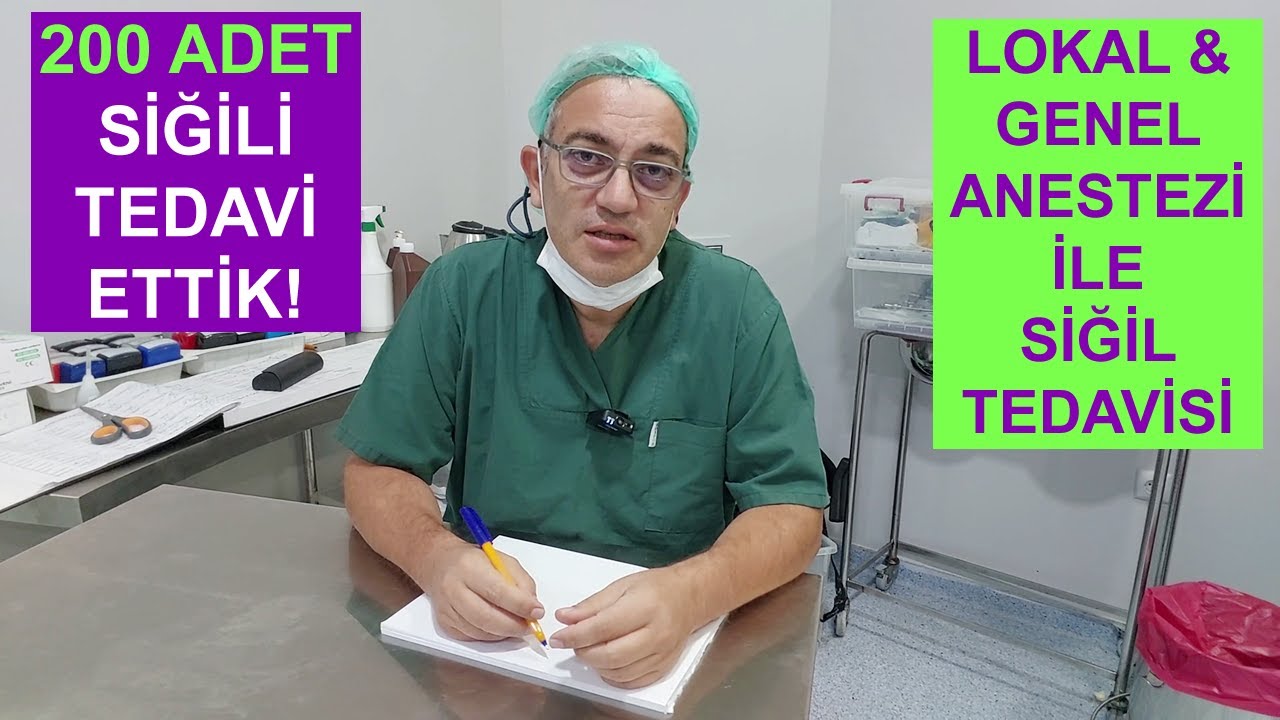 GENİTAL SİĞİL (HPV) 200 ADET YAKILDI: Kondilomların Lokal Anestezi ve Genel Anestezi ile Tedavisi