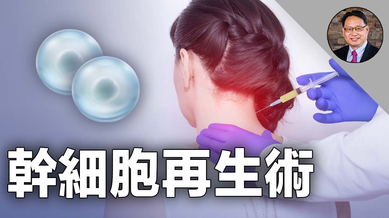 癱瘓也能治好？！幹細胞+泌外體治療讓多種疾病不再難治！
