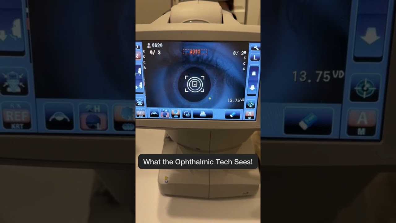 What We SEE vs What You SEE #eyetest #autorefractor #eyecare