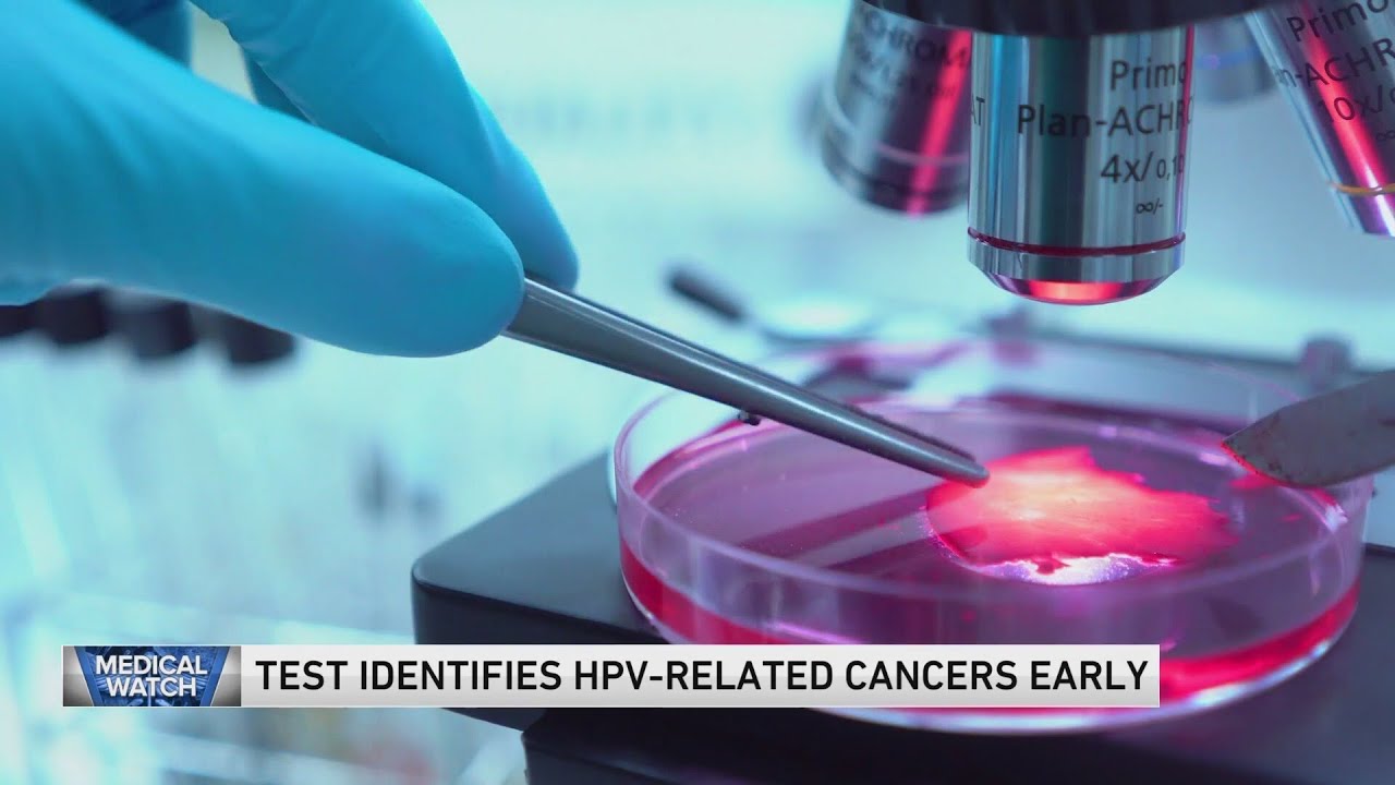 Test identifies HPV-related cancers early