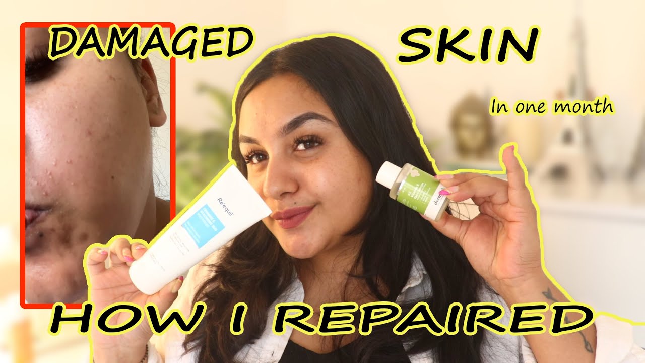 How I Repaired My DAMAGE SKIN Barrier ? PRODUCTS I USED FOR 1 MONTH? BEFORE & AFTER