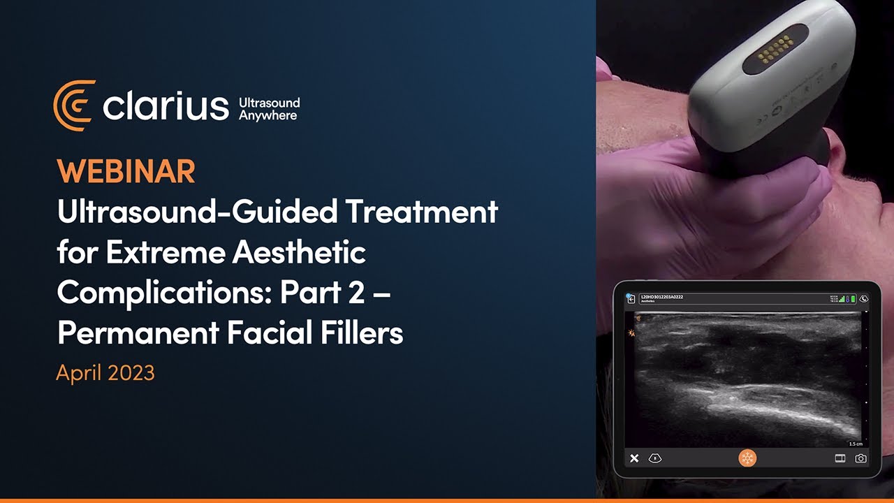 Ultrasound-Guided Treatment for Extreme Aesthetic Complications: Part 2 – Permanent Facial Fillers