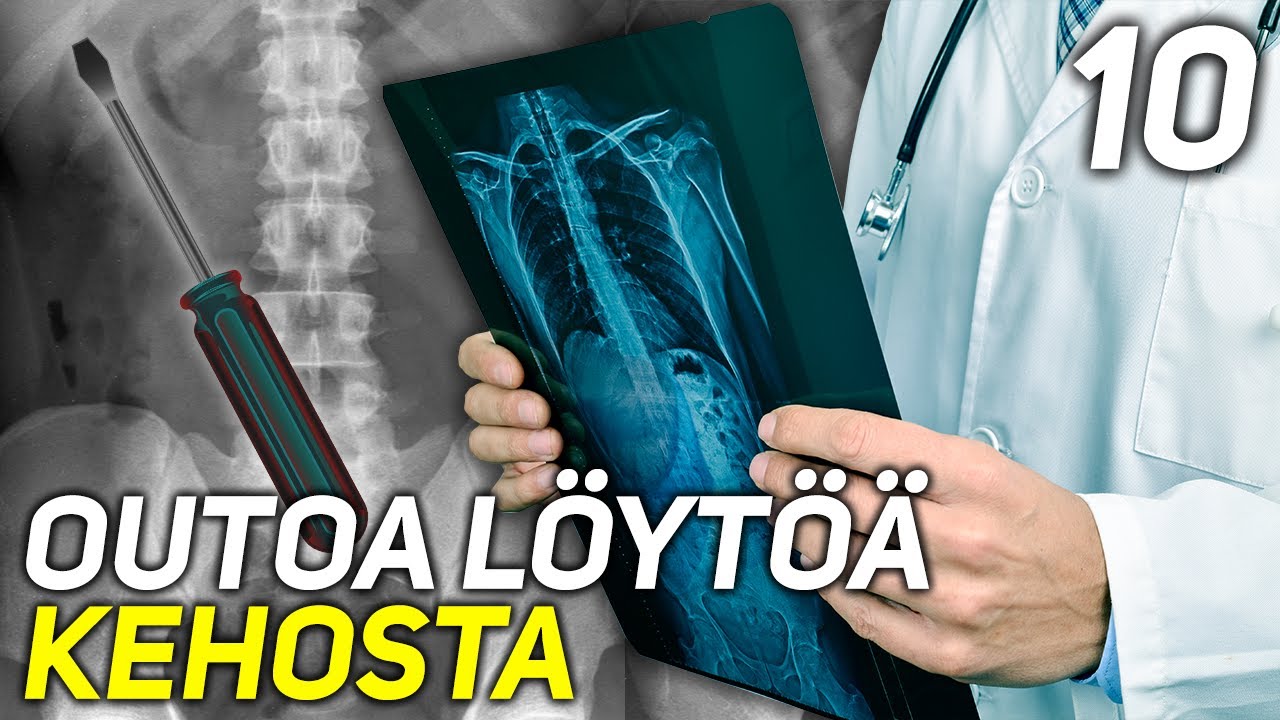 10 OUDOINTA IHMISEN SISÄLTÄ LÖYDETTYÄ ASIAA