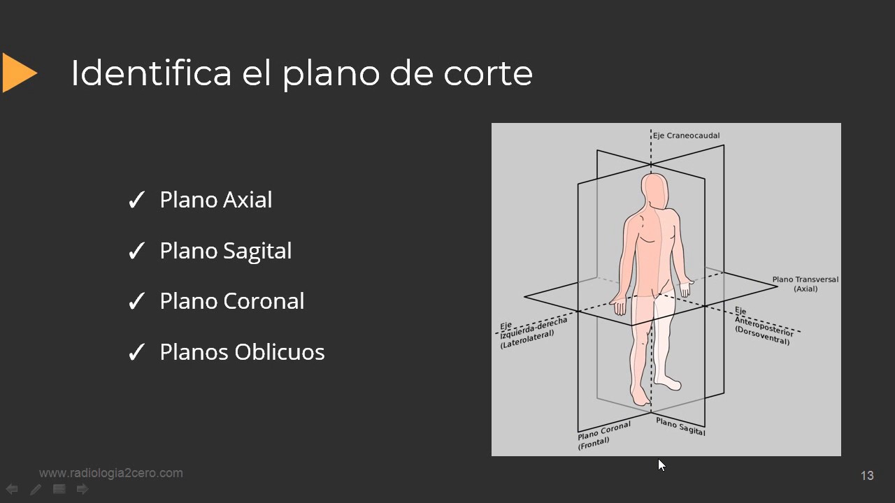 Cómo Describir una IRM