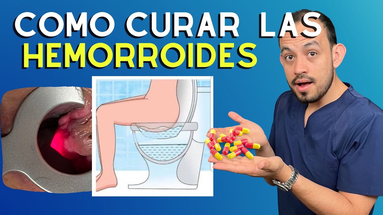 ☘️ El MEJOR Tratamiento de Las Hemorroides. ¿Pomada, Ligadura o Cirugía?  Lo Que Nadie Te Explica.