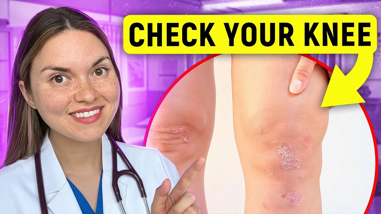 What Your KNEES Say About Your HEALTH: Arthritis Doctor Explains