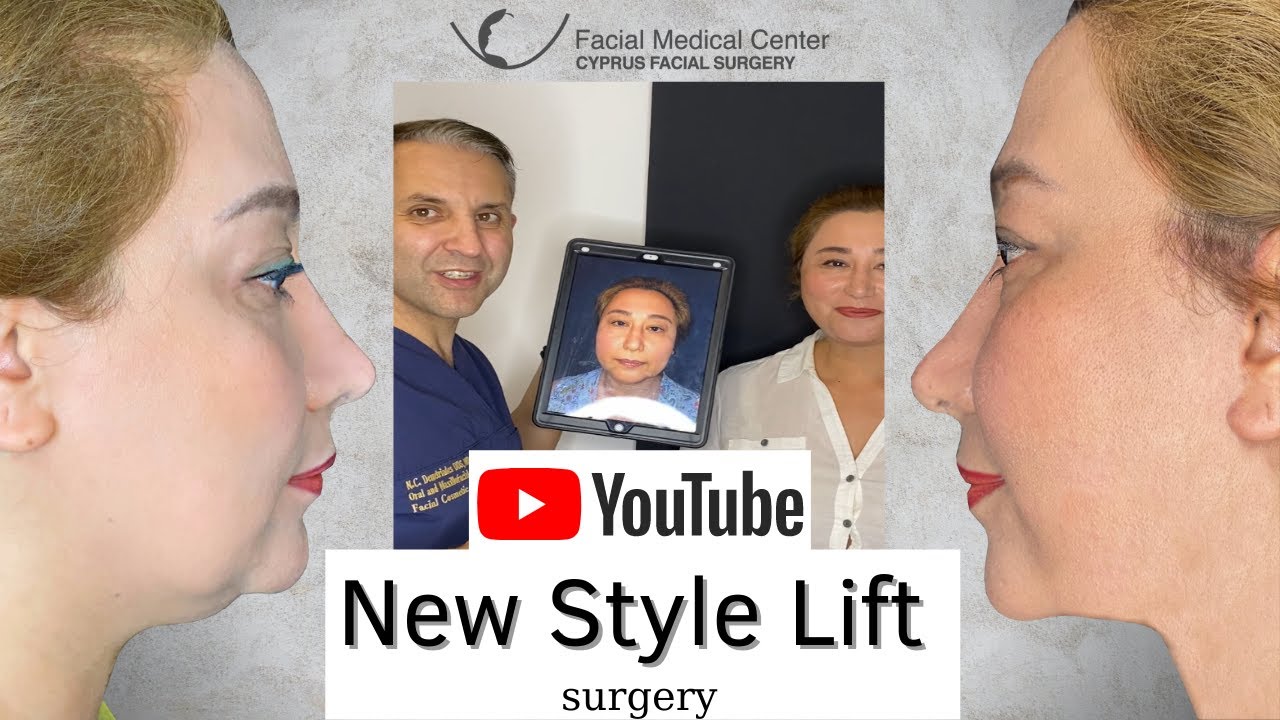 New Style Lift |Cyprus Facial Surgery