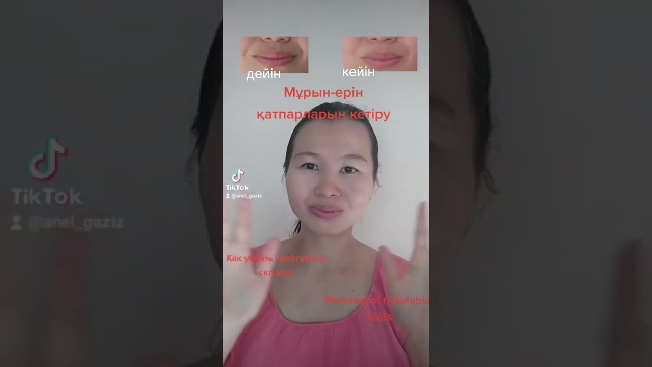 Мұрын-ерін қатпарларын кетіру Как убрать носогубных складок Removal of nasolabial folds