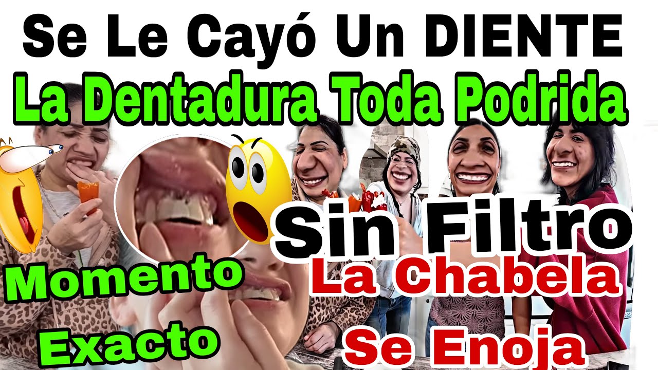 🦷Se Le Cayó El DIENTE🦷🤣La Dentadura Podrida😬Momento Exacto❗️Sin Filtros👩🏾🧟‍♀️La Chabela Se Enoja📸😤