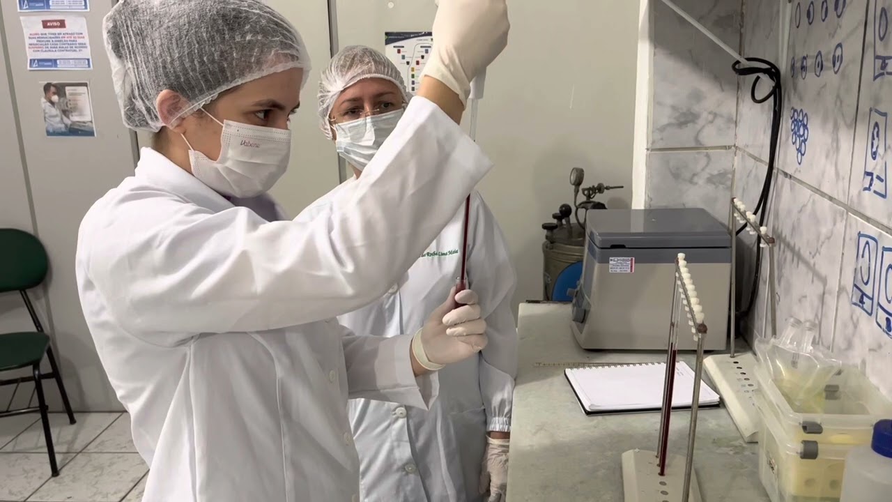 Exame VELOCIDADE DE HEMOSSEDIMENTAÇÃO - VHS (Método de Westergreen) Curso Alternativo (85) 3292-5263