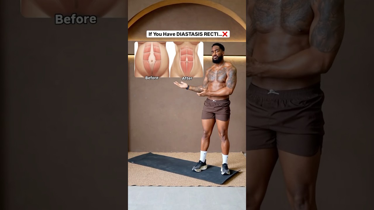 Do you have DIASTASIS RECTI?❌ (Do This✅)