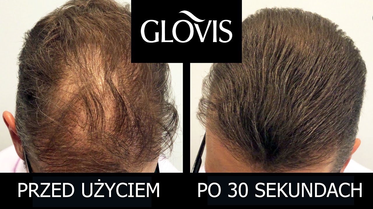Mikrowłókna do włosów GLOVIS. Gęste włosy w 30 sekund