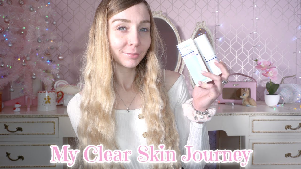 How I Got Clear Skin... Epiduo Journey 1 Year Update ♡ ZoeyGlitter