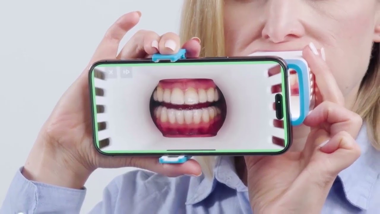 Invisalign Virtual Care