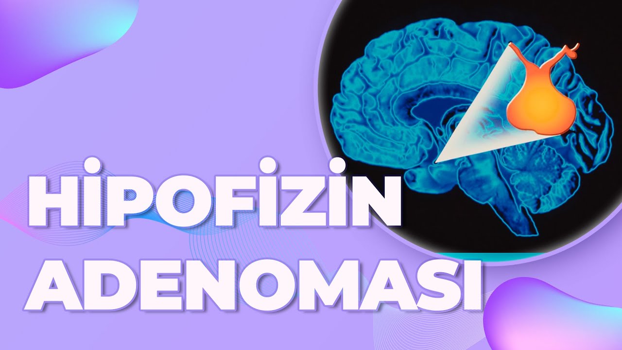HİPOFİZİN ADENOMASI / HİPOFİZ ADENOMASI MÜALİCƏSİ?- SALAM HƏYAT