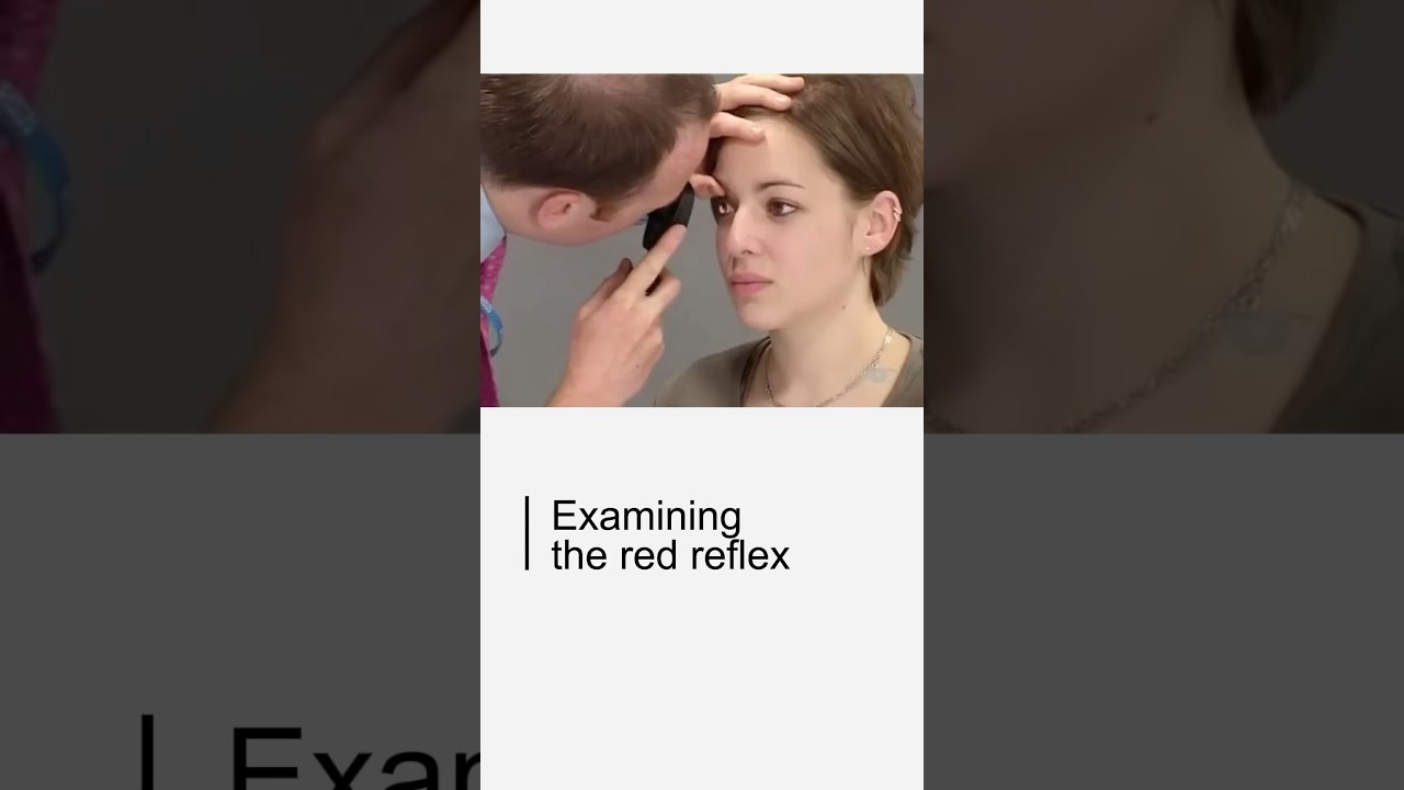 Examining the red reflex &ndash; part 1 #ophthalmology