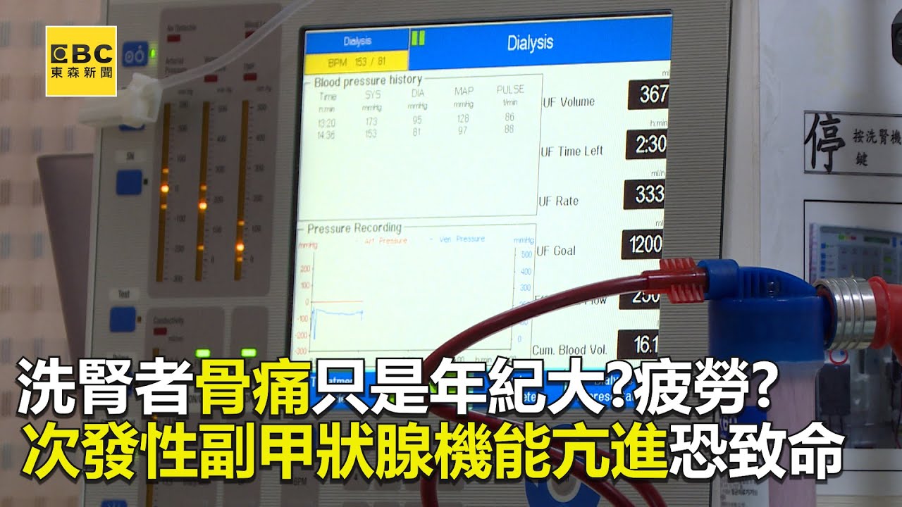 洗腎者骨痛只是年紀大？疲勞？ 次發性副甲狀腺機能亢進恐致命