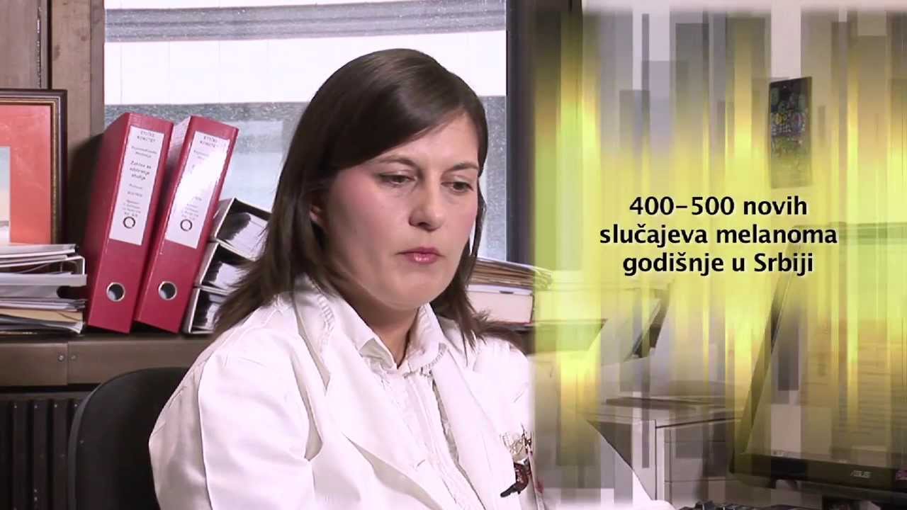 Epidemiologija melanoma