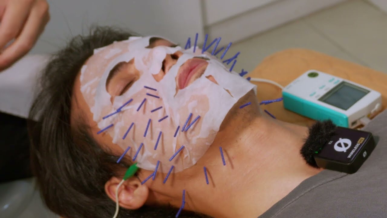 Most Gentle Electroacupuncture Experience - Soft Spoken