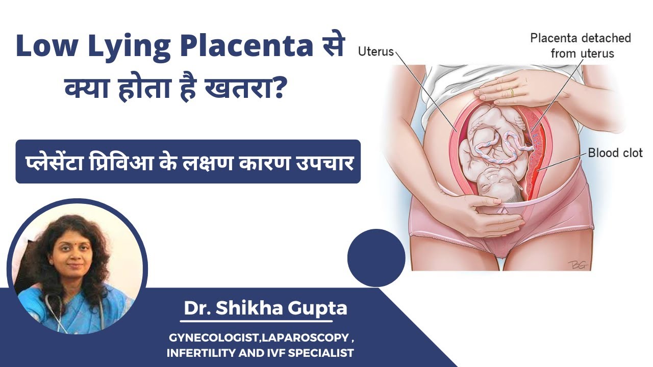 Low Lying Placenta क्या है ? | LOW LYING PLACENTA से प्रेगनेंसी में  क्या हो सकता है ?
