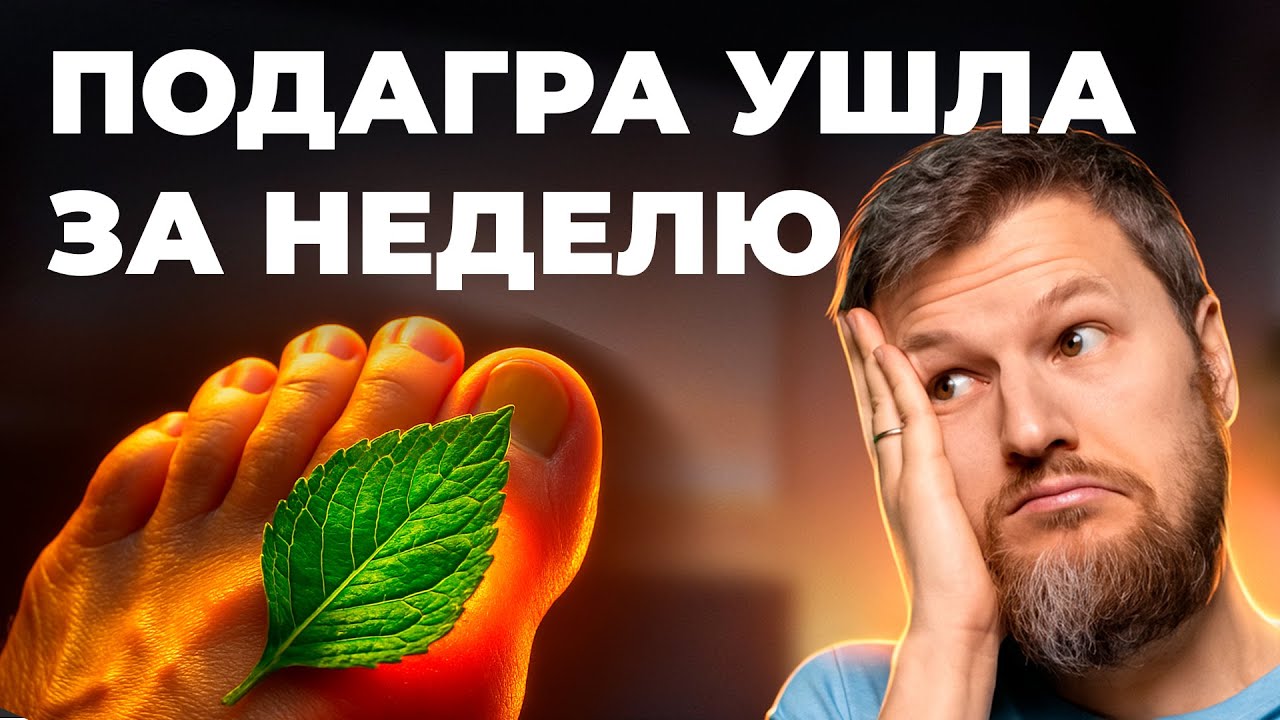 Прощай, подагра! Эффективное лечение, которое ДЕЙСТВИТЕЛЬНО помогает!