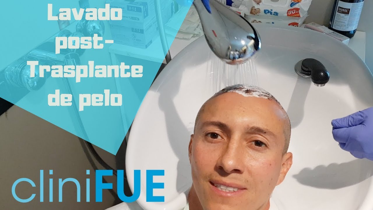Instrucciones LAVADO tras el TRASPLANTE CAPILAR - cliniFUE Mayo 2018
