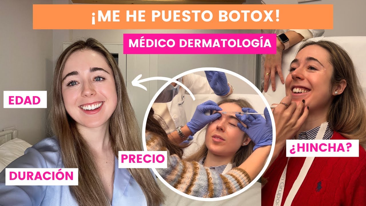 MÉDICO SE PONE BOTOX | ¿FUNCIONA? ¿HINCHA? EDAD, PRECIO, EFECTOS SECUNDARIOS | PATAS DE GALLO...