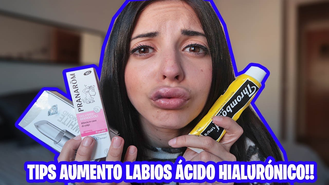 💋 TIPS AUMENTO de LABIOS con &Aacute;CIDO hialuronico!! 💋