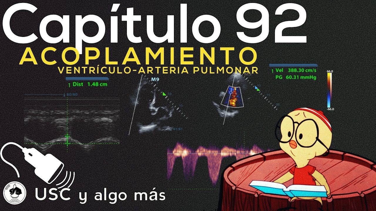Capitulo 92 Acoplamiento Ventrículo - Arteria Pulmonar