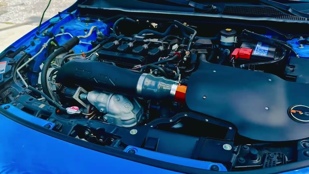 Turbo Noises - 27Won Inlet Pipe & Cold Air Intake (CAI) - Honda Civic FL1