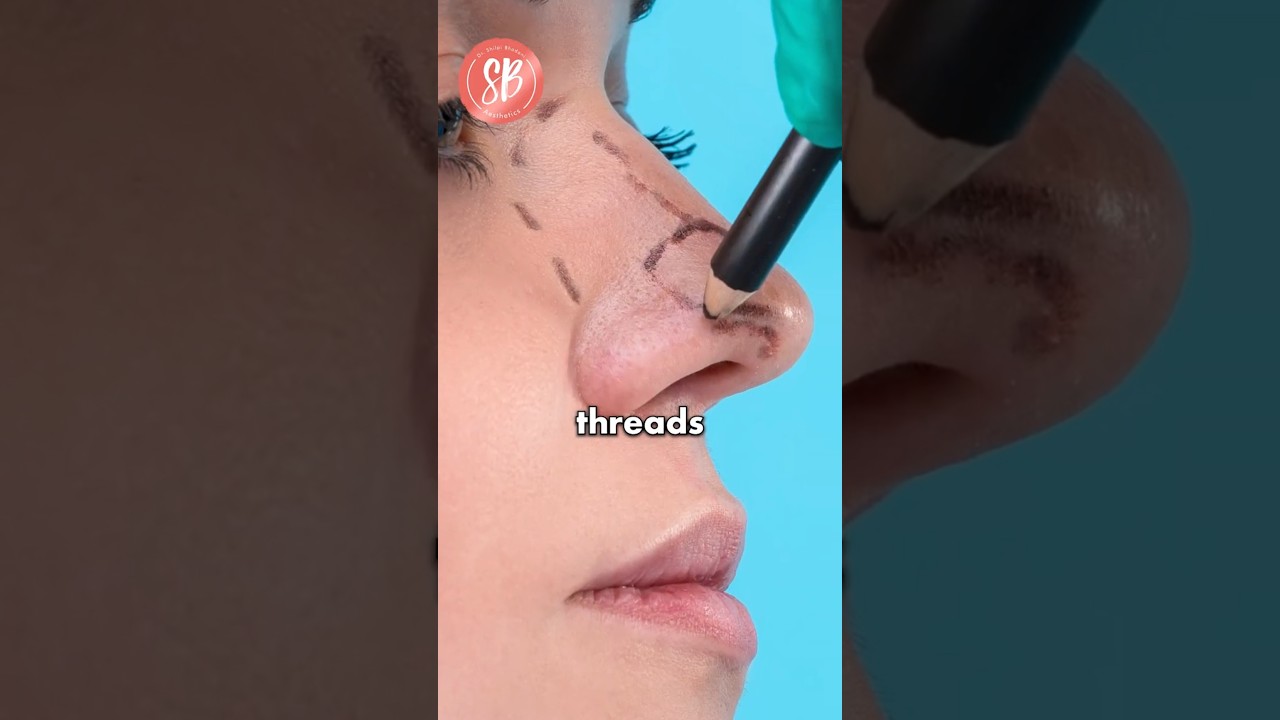 Nose Thread Lift vs Rhinoplasty : Which one is better? 